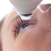 Patient being treated by Zeiss Visumax Laser