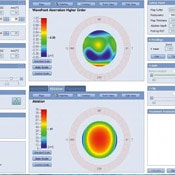 Zeiss MEL80 Treatment map