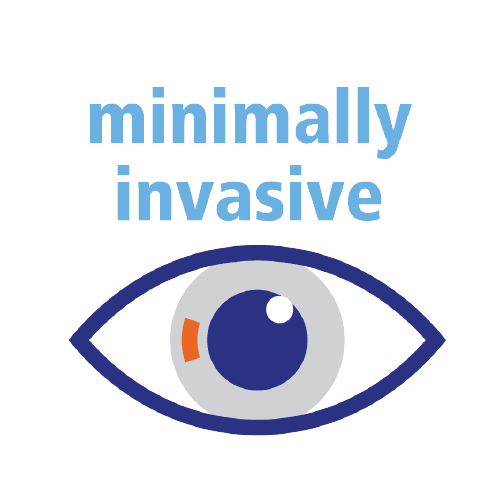 Advanced Minimally Invasive LASIK Techniques for Vision Clarity