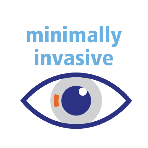 Advanced Minimally Invasive LASIK Techniques for Vision Clarity