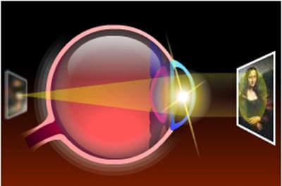 Hyperopic eye seeing objects