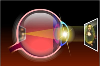 Myopic eye seeing objects