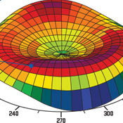 Contoura map of the eye