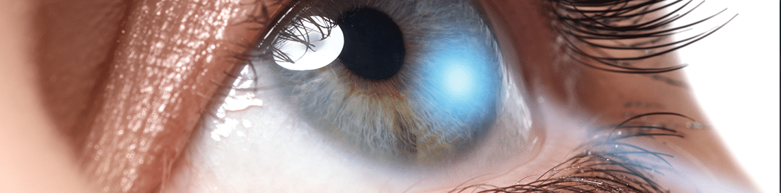 Astigmatism LASIK