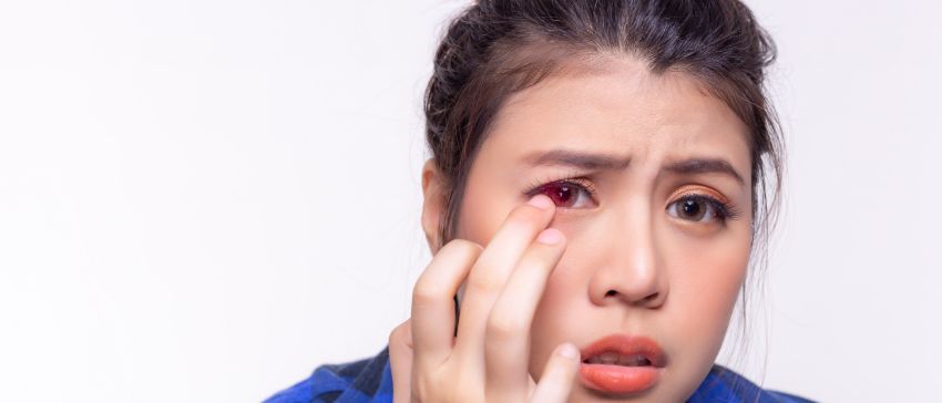 Contact Lens Intolerance Allergies